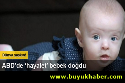 ABD'de 'hayalet' bebek doğdu