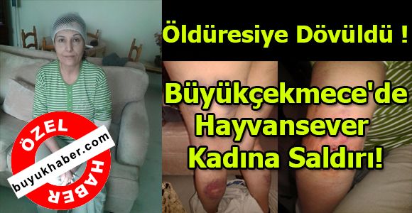 Büyükçekmece'de Hayvansever Kadına Saldırı!