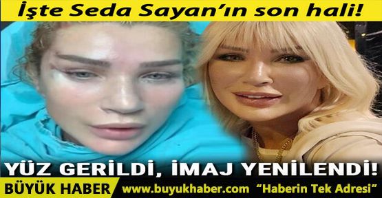 Seda Sayan'ın son hali! Yüz gerildi, imaj yenilendi