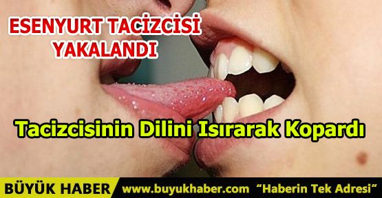 Tacize Uğrayan Kadın Tacizcisinin Dilini Isırarak Kopardı